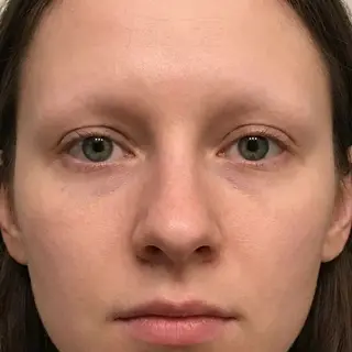 A human face with eyes, nose, and mouth but no eyebrows