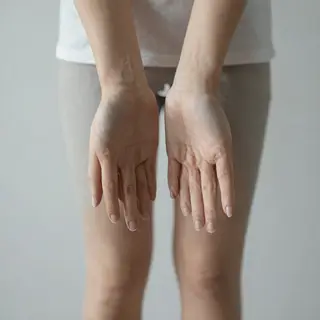 A person standing with both hands visible at their sides, fi