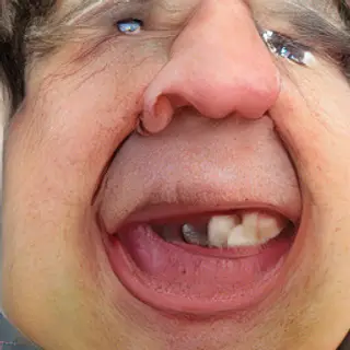 A close-up of a person's face showing clear disgust, nose wr
