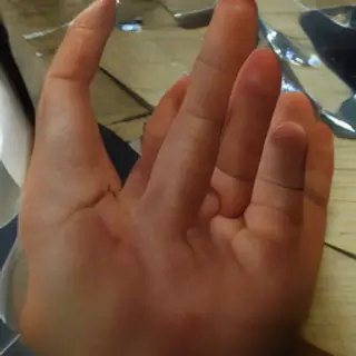 A hand giving a thumbs-up with four fingers curled and thumb