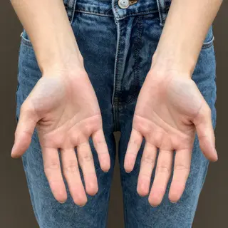 A person standing with both hands visible at their sides, fi